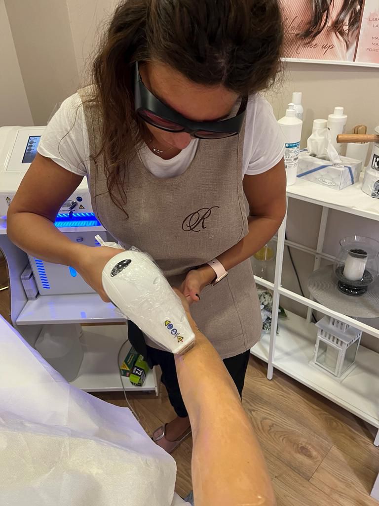 Trattamento epilazione laser professionale